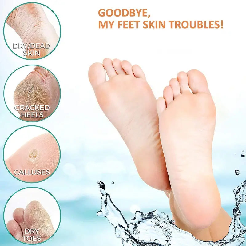 Electric Callus Remover with Vacuum